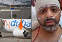Captain Smit Machchhar, skull fracture, emergency surgery, Abu Dhabi hospital